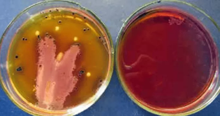 Рост культур Salmonella enteritidis из проб инфицированного сальмонеллами корма на XLD-агаре..jpg