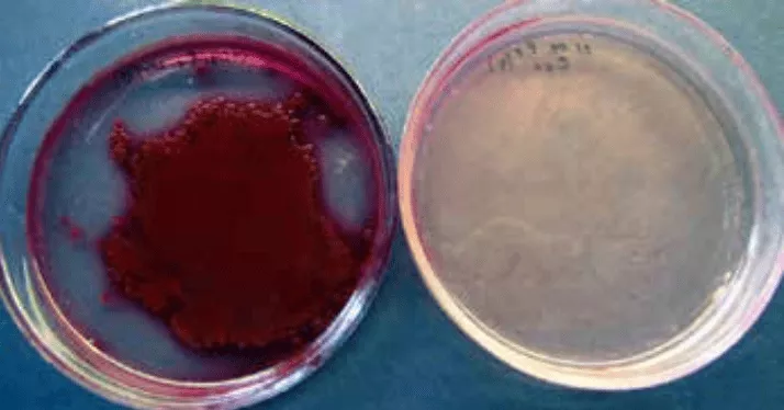Рост культур Escherichia coli из проб инфицированного кишечной палочкой корма на среде Эндо.